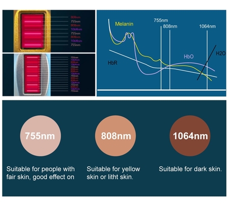 4 dalga diyot lazer ağrısız saç çıkarma makinesi 755nm 940nm 1064nm