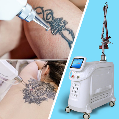 OEM ODM Özel 15 Inç Renkli Dokunmatik Ekranlı Pikosekondlu Lazer Dövme Eliminasyon Makinesi