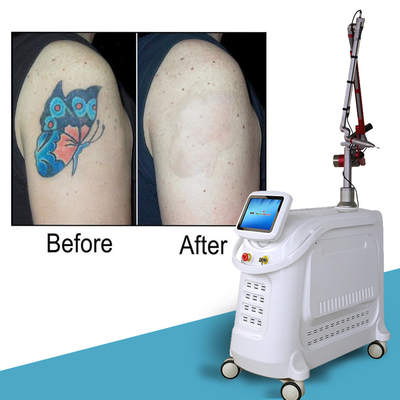 1064nm Q Switched Nd Yag Laser Picosecond Dövme Kaldırma Makinesi Sabit Stil