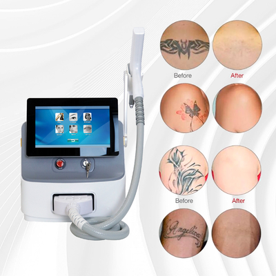 Taşınabilir Pico saniye lazer makinesi 1064nm 532nm Pico lazer dövme çıkarma makinesi