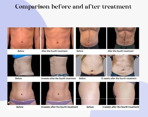 Ağırlık Kaybı Vücut Slim RF EMS Kas Stimülatörü Makinesi Hızlı Slim Vücut Heykel için