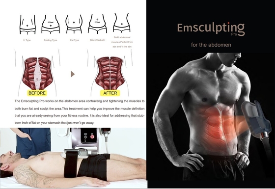 Ticari EMS Gevşetme Makinesi Güzellik Salonu / Spa için 10 inçlik dokunmatik ekran
