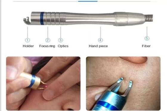 Ayak tırnağı tedavisi / sıcak lazer cilt gençleştirme için 15W 30W lazer damar çıkarma makinesi