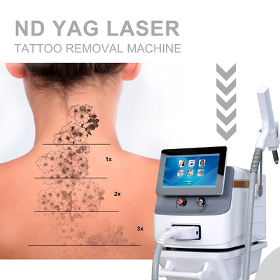Q Switch Nd YAG Lazer Dövme Kaldırma Makinesi 1064nm 532nm 1320nm