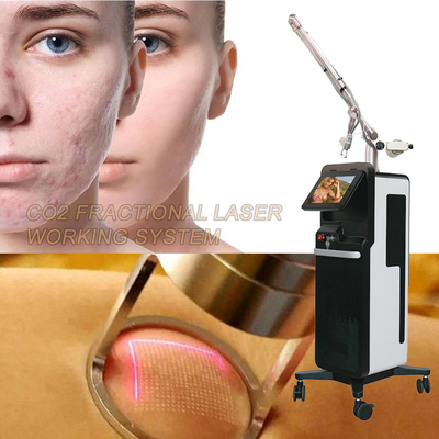 Cildin Parlaklaşması ve Dayanması İçin Karbon Dioksit Lazer Kısıtlı CO2 Makinesi
