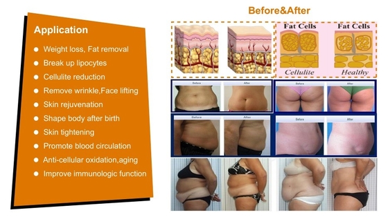 Ticari Kavitasyon RF Vacuum Slimming Machine 7 in 1 Güzellik Merkezi için